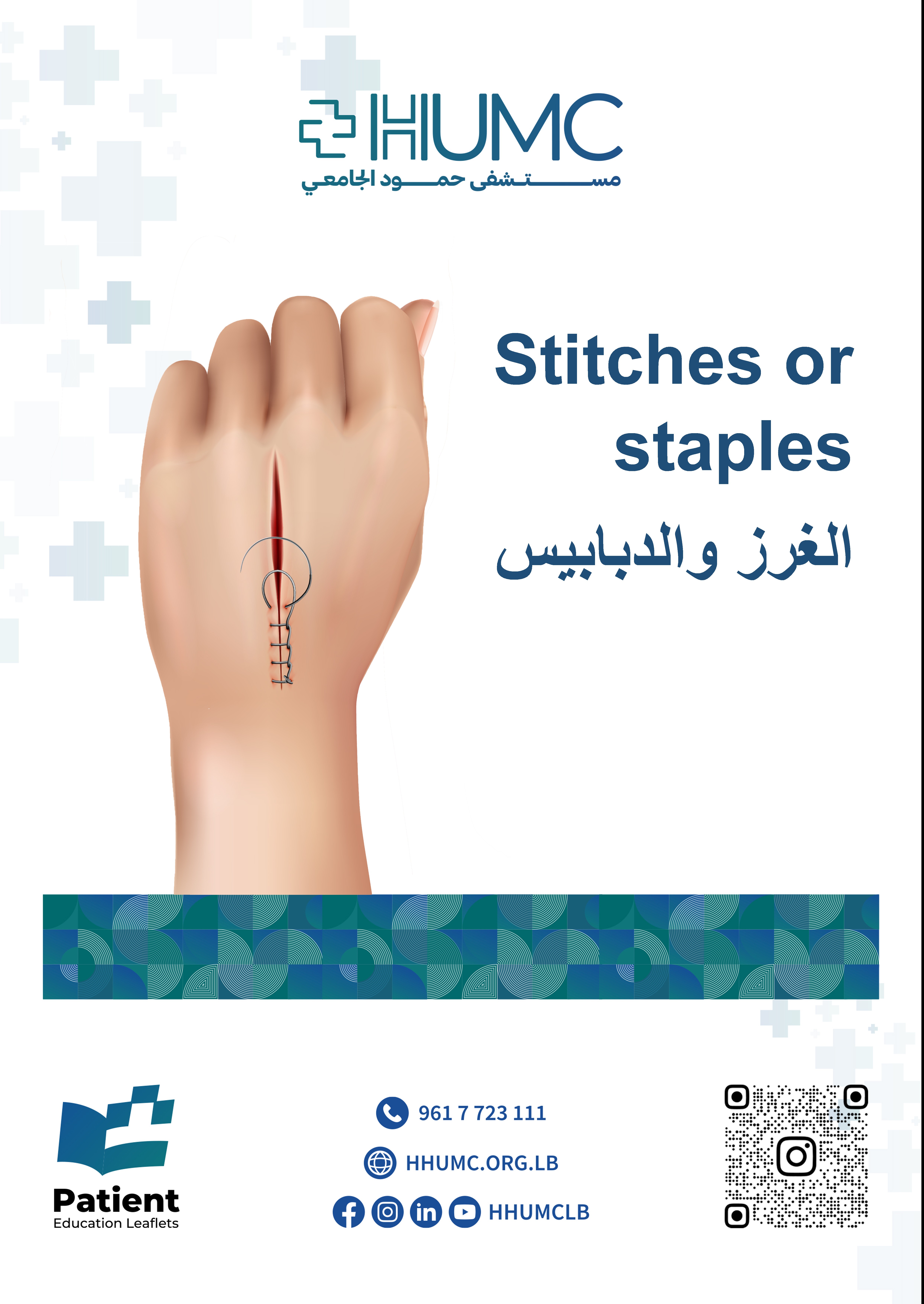 Stitches or staples